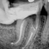 Imagem aspecto radiográfico final