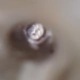 Imagem conduto obturado com o material adequado