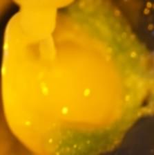 Imagem pino de fibra e preenchimento colocados em posição, garantindo maior resistência do dente em questão