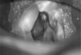 Conheça essa tecnologia: Irrigação passiva (PUI e CUI) em todos os casos